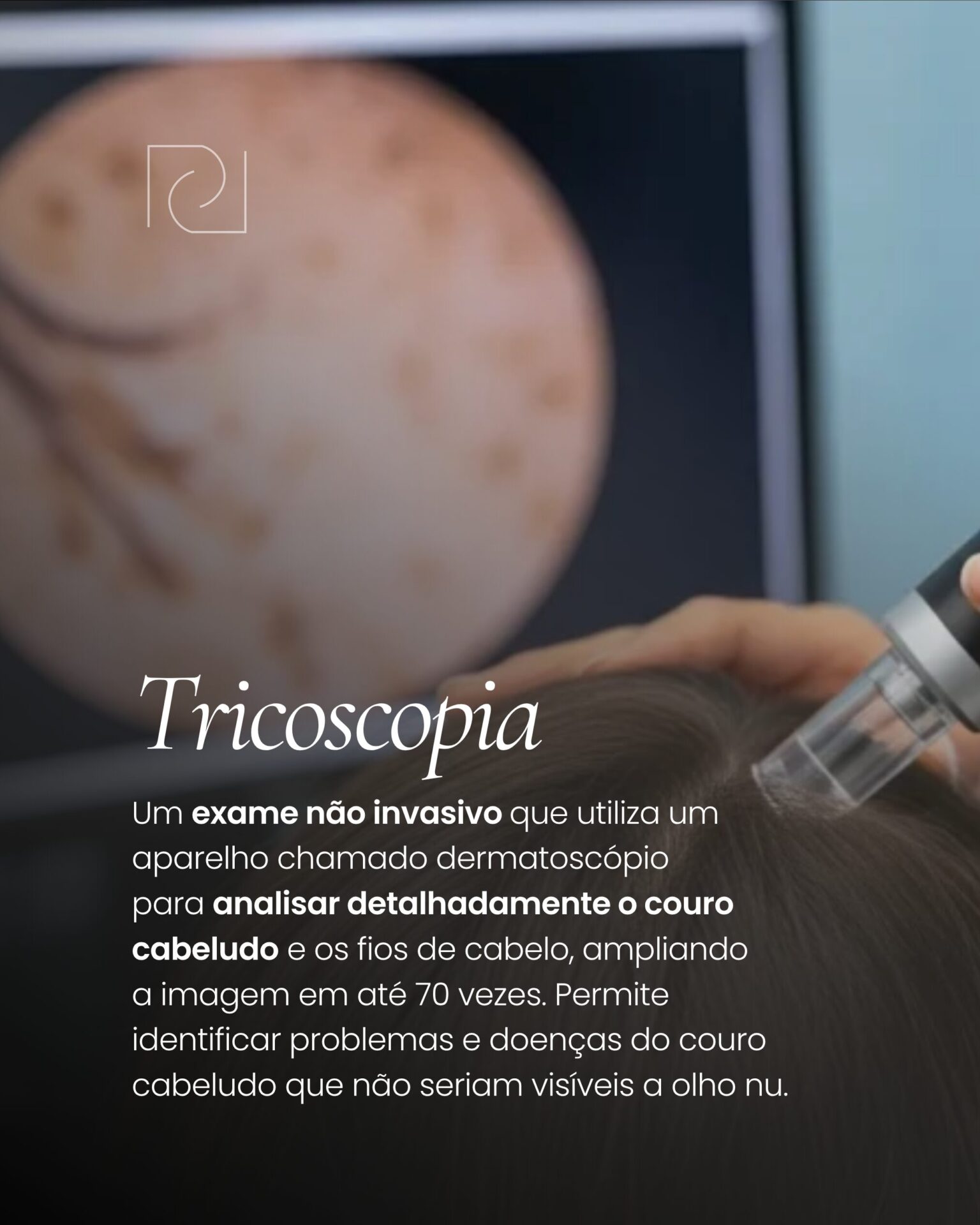 Tricologia e Tratamentos Capilares Personalizados – Renata Garla ...